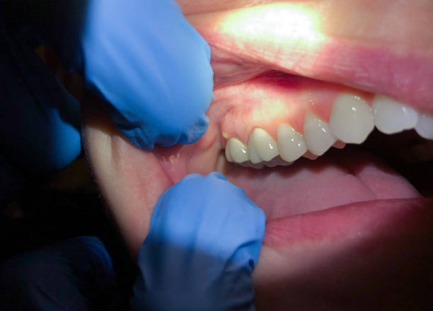Best Emergency Root Canal Treatment in Pittsburg, KS